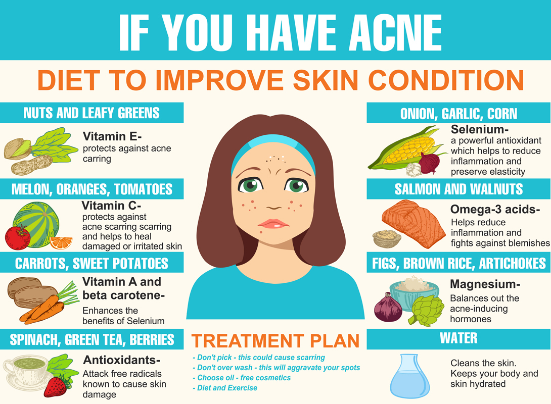 How to prepare a diet to fight your acne - some tips just for you!