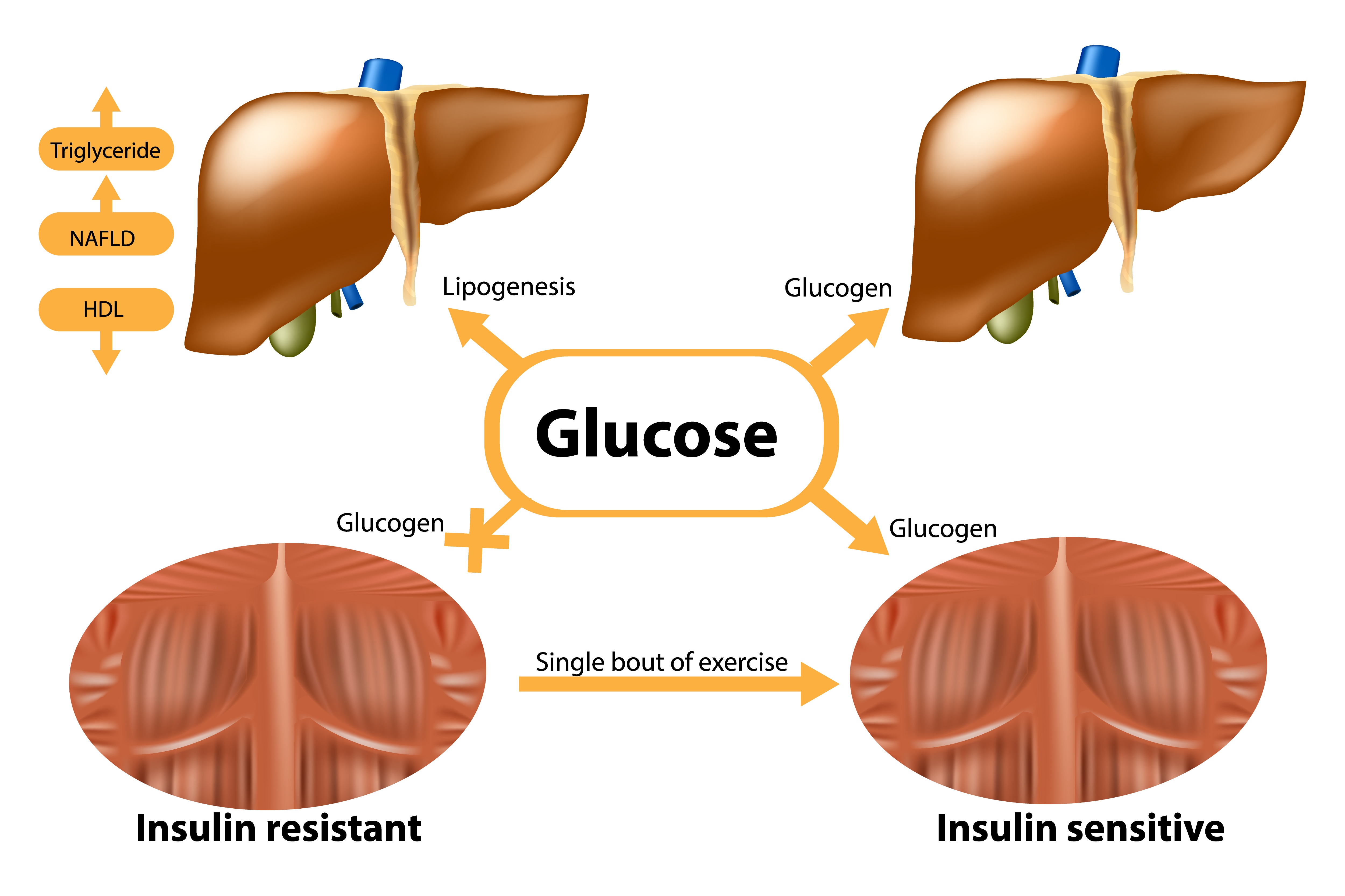 Glucose metabolism - infographic