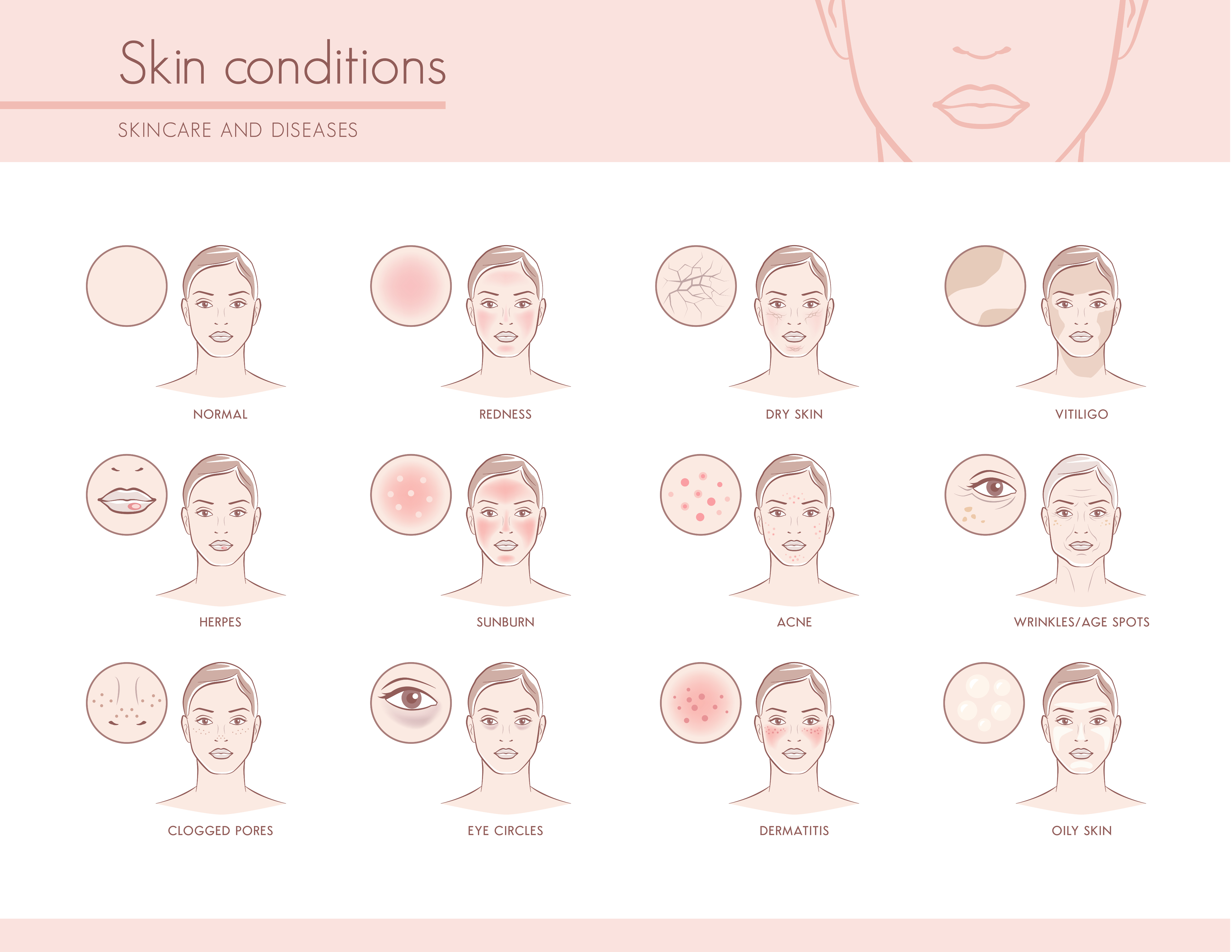 Skin conditions - infographic