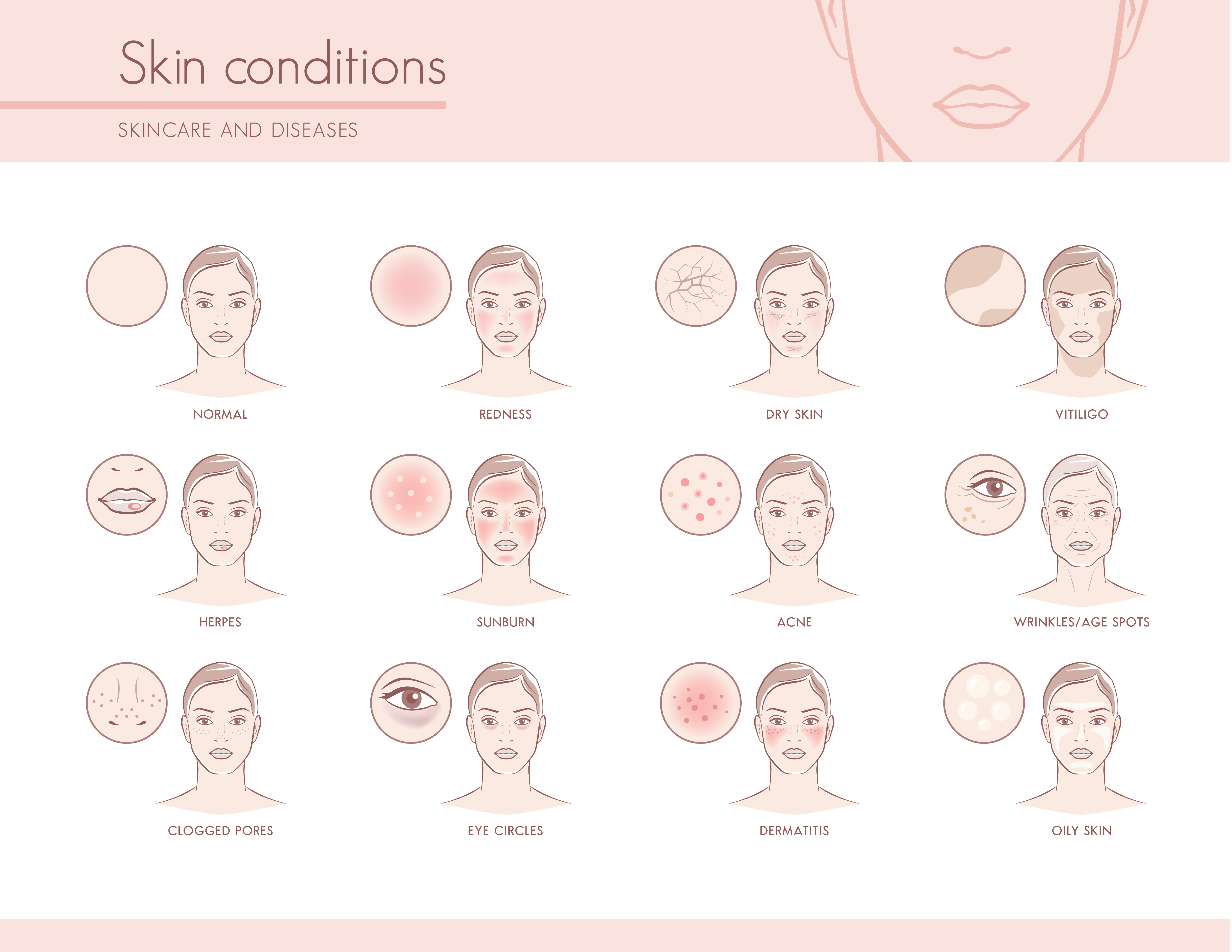 Skin conditions - infographic