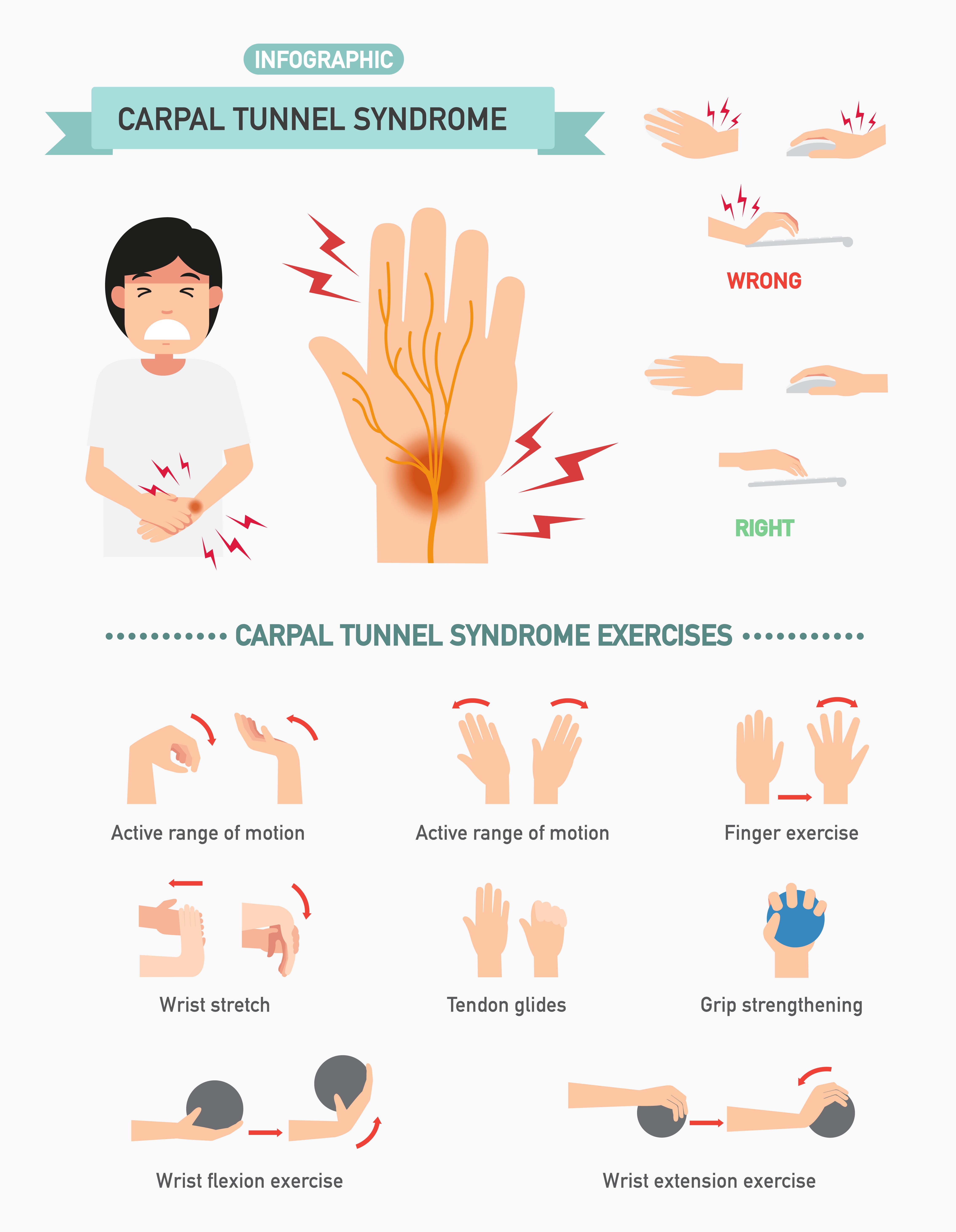 Carpal Tunnel Syndrome - symptoms, causes and treatment