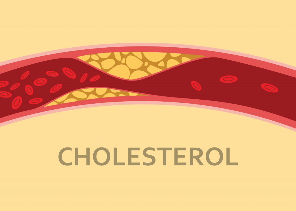 Cholesterol Compedium