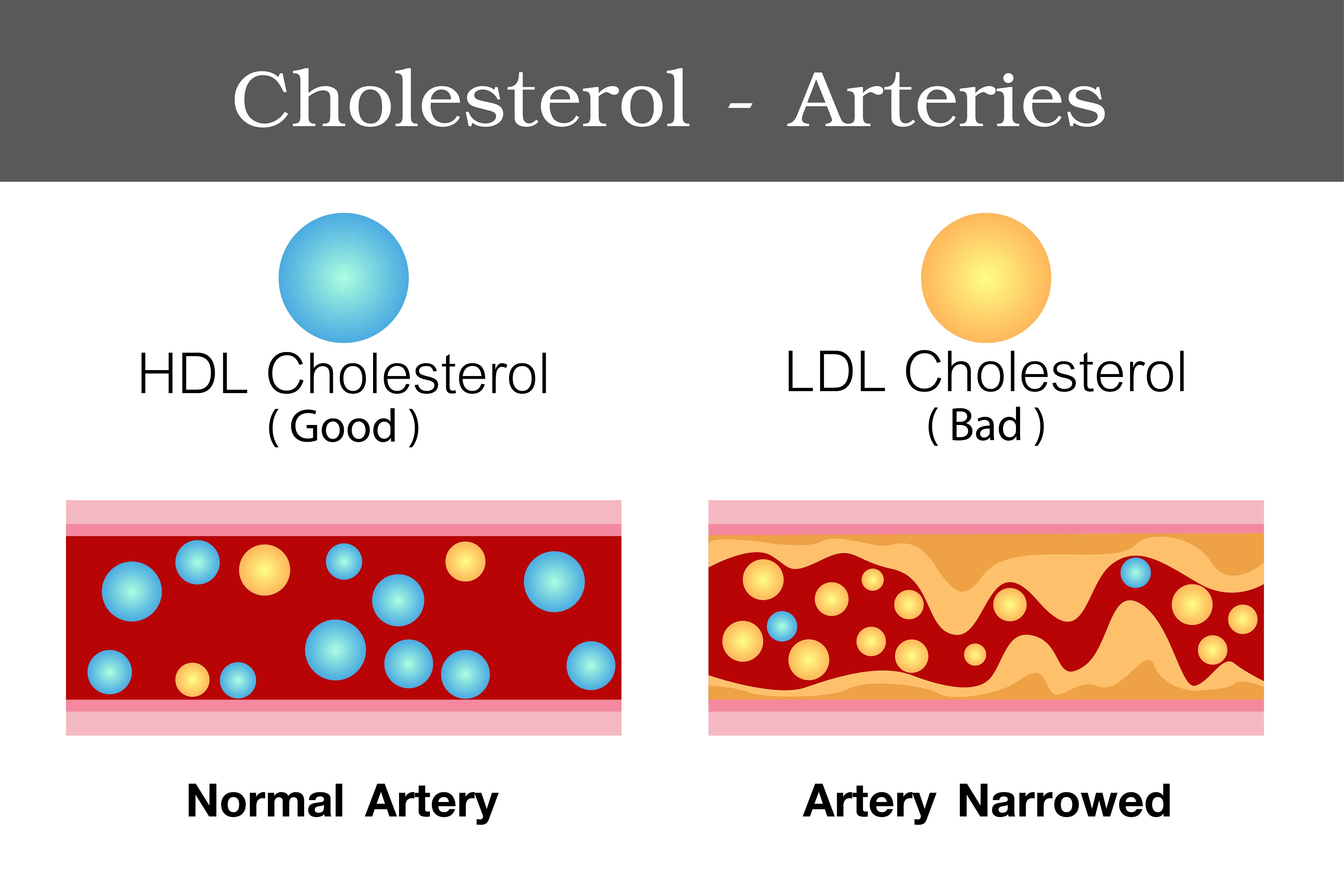 How different fractions of cholesterol acts on our arteries?