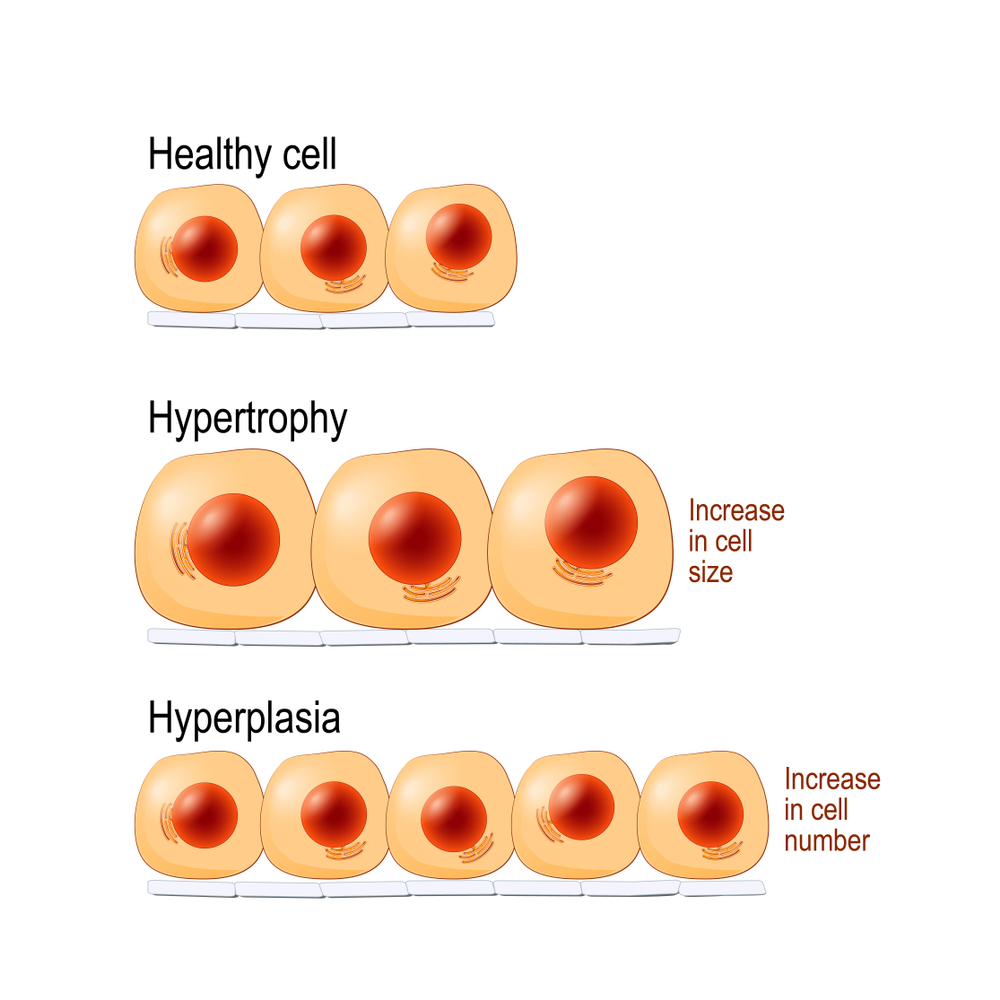 Hypetrophy is nothing more than increasing size of cells - here we mainly mean muscle cells of course!