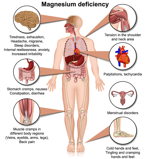 Symptoms of magnesium deficiency