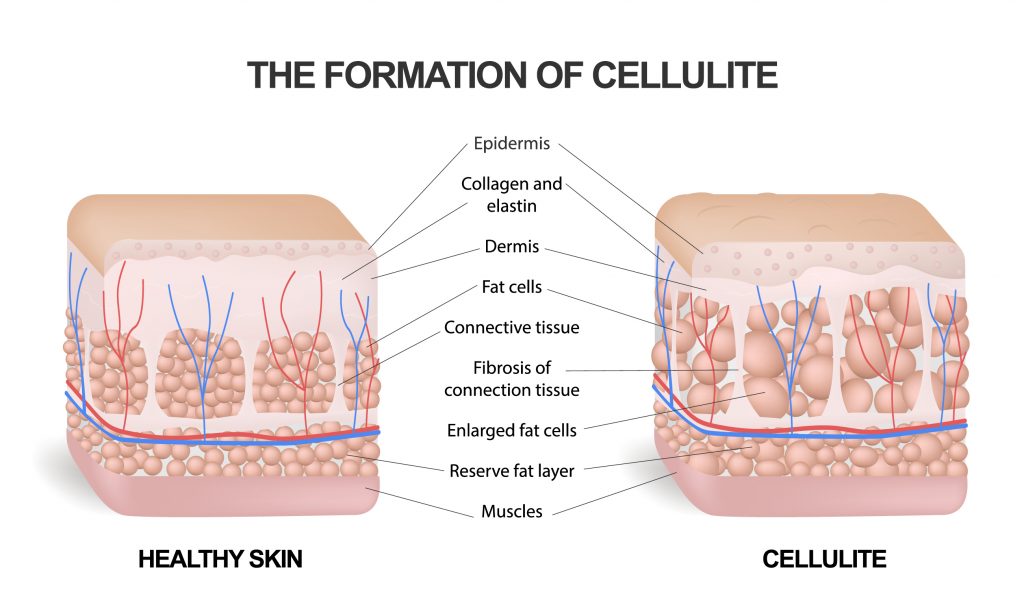 How to improve skin quality