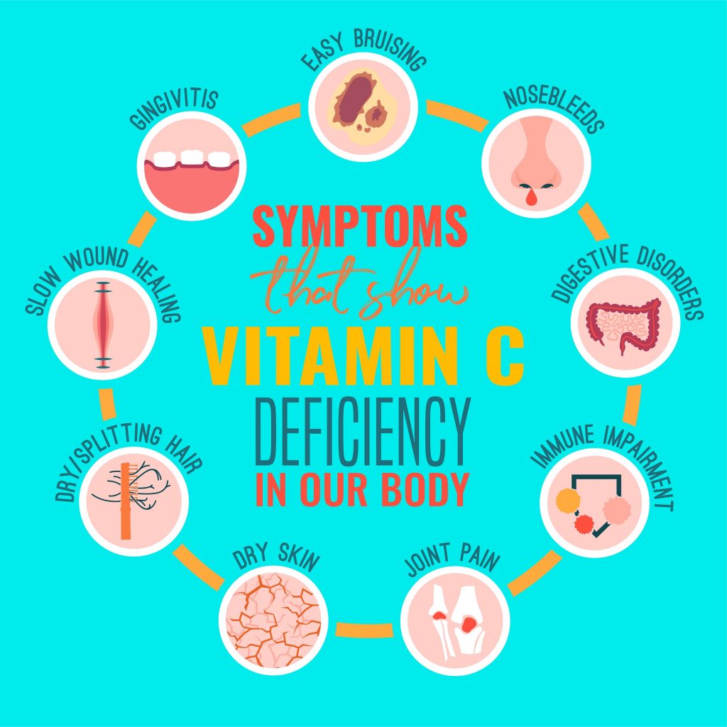 Extensive bruises is one of the most significant symptoms of Vitamin C deficiency