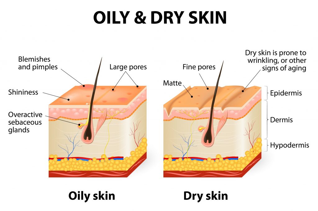 Oily vs Dry skin condition